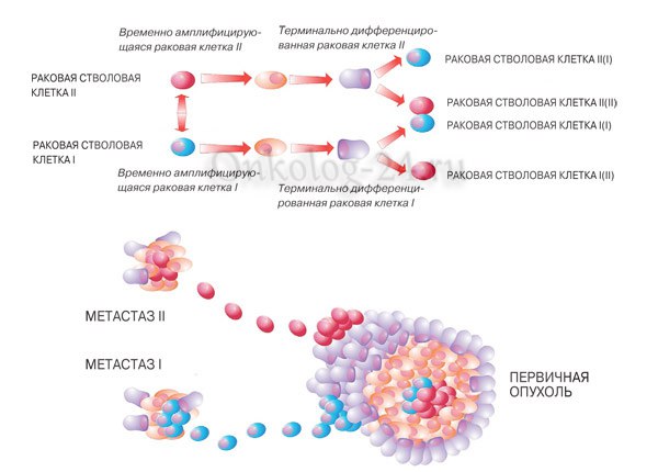 metastazy v limfouzlakh