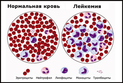 Процесс созревания лейкоцитов