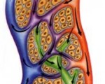 Рак лимфоузлов: симптомы, признаки, причины, прогноз и лечение