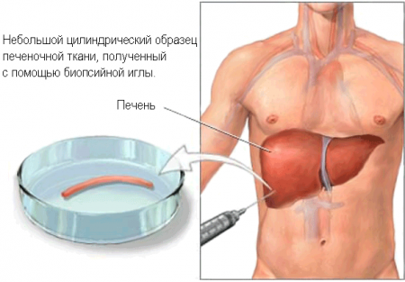 Способы диагностики