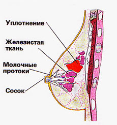 Симптоматические проявления