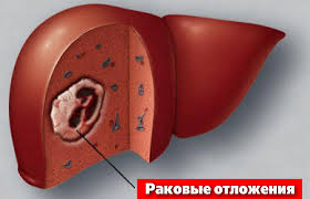 Основные положения при лечении