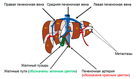 Лечение рака печени