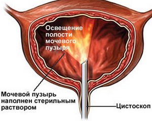 Методы диагностики