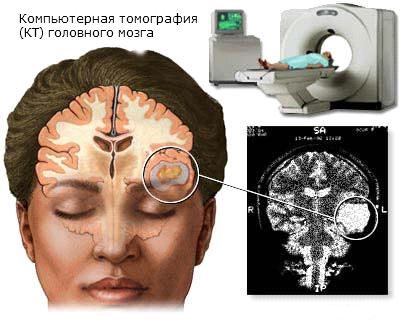 Выявление заболевания