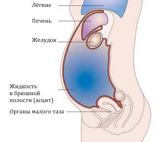 Определение симптомов в брюшной полости