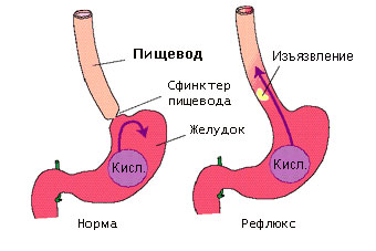 Проявление рака