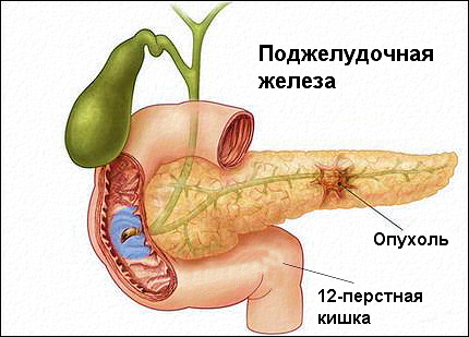 Поджелудочная железа