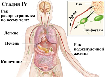 Прополис для лечения предстательной железы